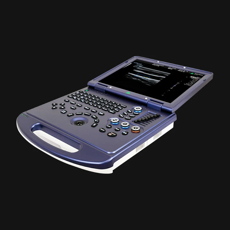 Hikari H30 - カラードップラー機能搭載ポータブル超音波診断装置