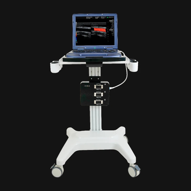 Hikari H30 - カラードップラー機能搭載ポータブル超音波診断装置